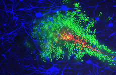 Nanoparticles with very dense PEG coatings (green) are shown penetrating within brain tissue in vivo.